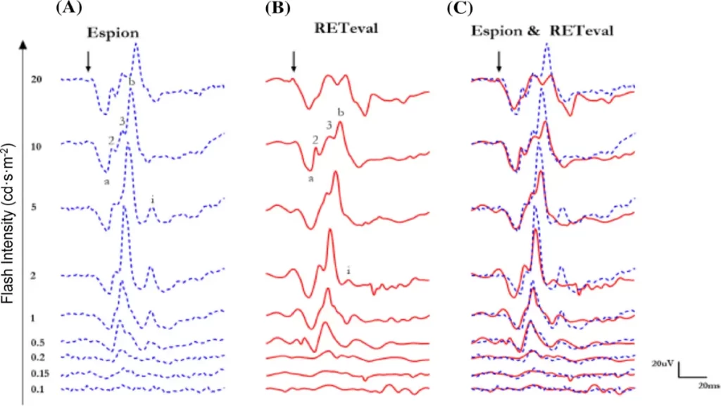 جواب نوار عصب و عضله تفسیر نوار عصب و نمودارهای موجود در جواب