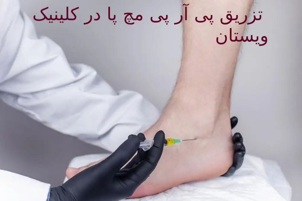 تزریق PRP مچ پا توسط بهترین متخصص کلینیک ویستان سال 1403