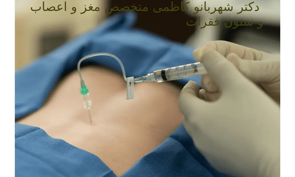 تزریق استروئید اپیدورال برای درمان تنگی کانال نخاع از ویستان