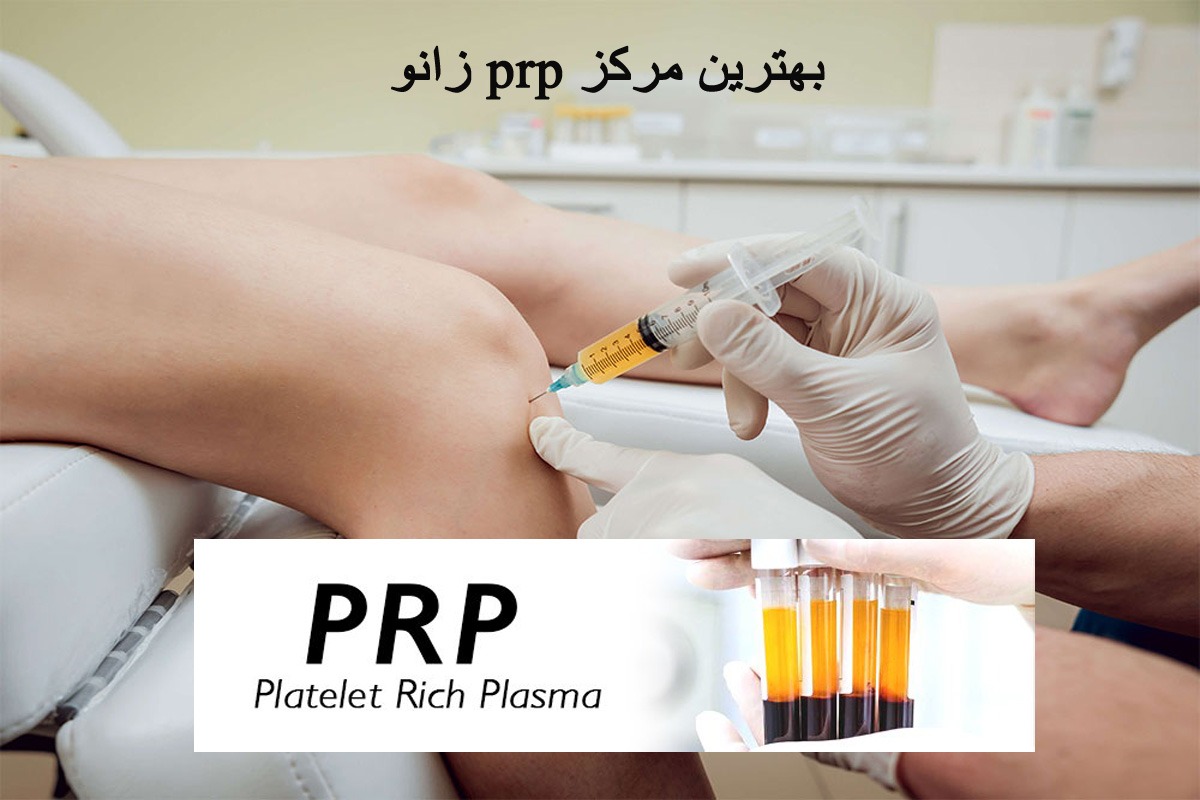 مرکز پی آر پی زانو