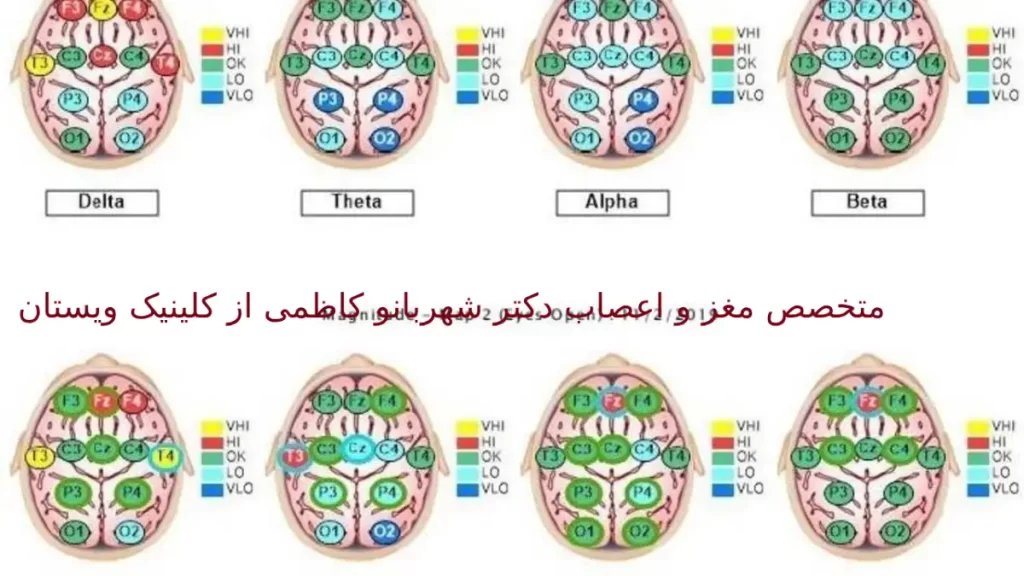 نوار مغز می‌تواند نشان‌دهنده آسیب‌های مغزی باشد.