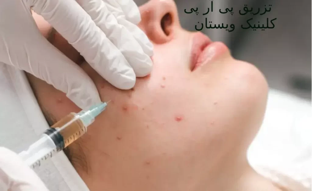 عوارض جانبی پی آر پی بسیار کم است.