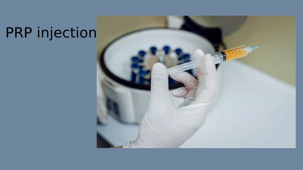 تزریق prp تزریق پی آر پی چیست؟ | بهترین متخصص PRP در مرزداران✔
