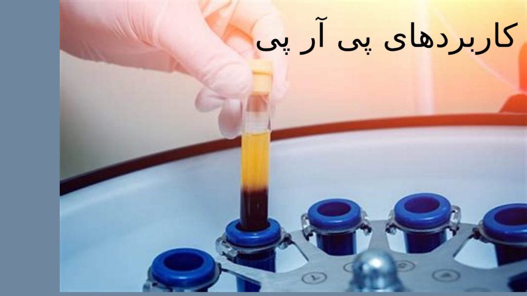 مهم ترین کاربردهای پی آر پی پی ار پی برای چه مشکلاتی مناسب است