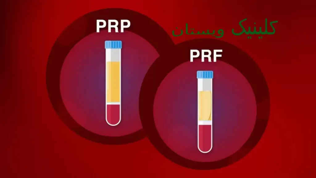 ترکیبات طبیعی بدن به بهبود پوست کمک میکنند. PRP همچنین برای کاهش پف و تیرگی زیر چشم کاربرد دارد.