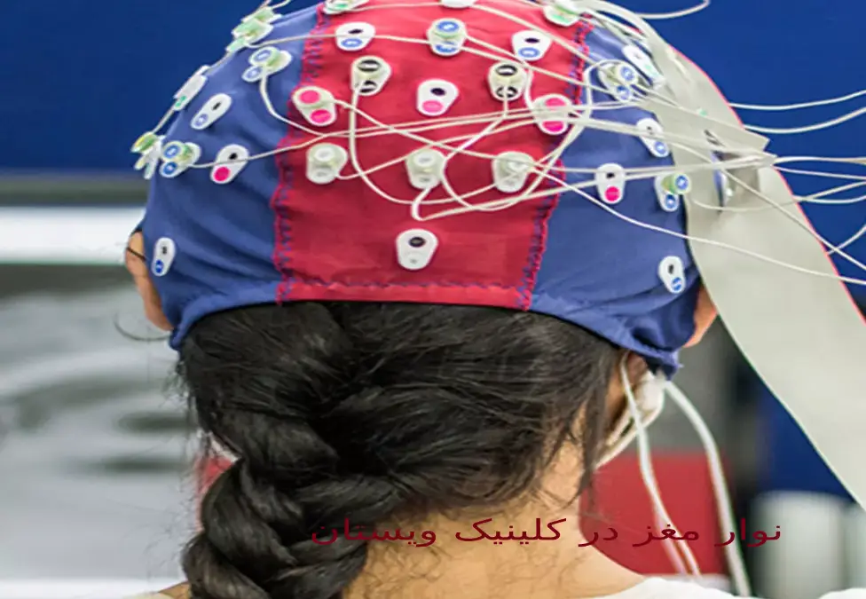 هزینه نوار مغز در کلینک و نقشه مغز qEEG چگونه انجام می شود؟