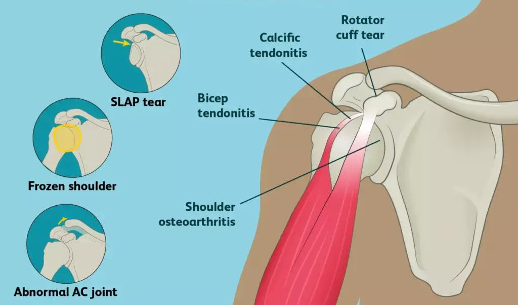 پی آر پی در مقایسه با سایر روشها هزینه کمتری دارد دکتر شهربانو کاظمی و دکتر فهیمه تفتی معمولاً قبل از اقدام به این درمان، سوابق پزشکی بیمار را بررسی میکنند.