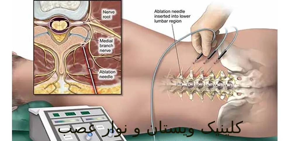 دکتر کاظمی به روزترین روشهای درمانی را به کار میبرد. نوار عضله به شناسایی بیماریهای عضلانی کمک میکند.
