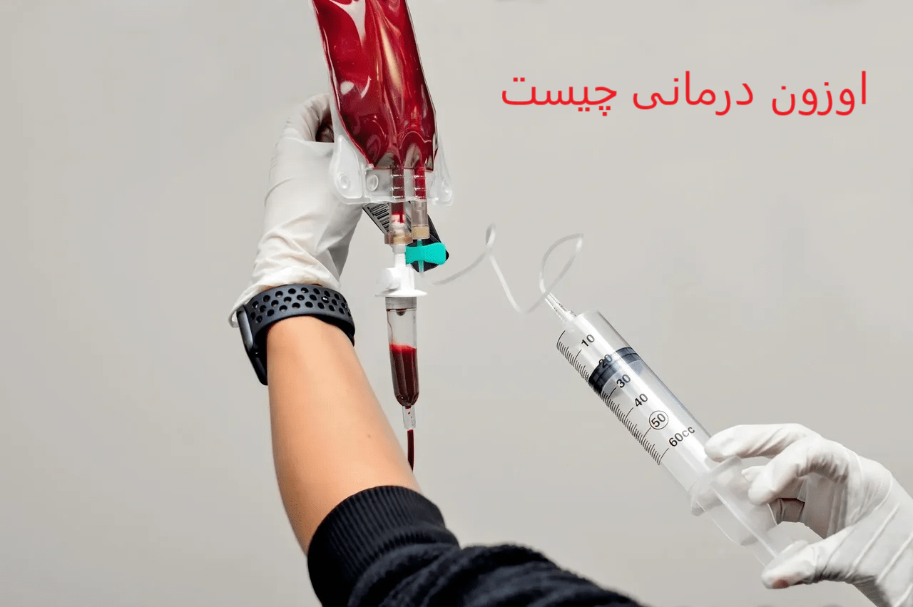 پزشک معالج در حال آماده سازی اوزون درمانی است