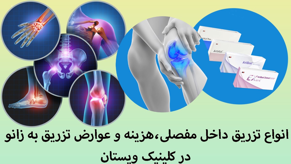 چند تصویر در یک قاب از تزریق داخل مفصلی