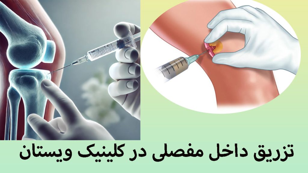 تزریق داخل مفصلی دو تصویر که تزریق داخل مفصلی زانو و شانه را نشان می دهد