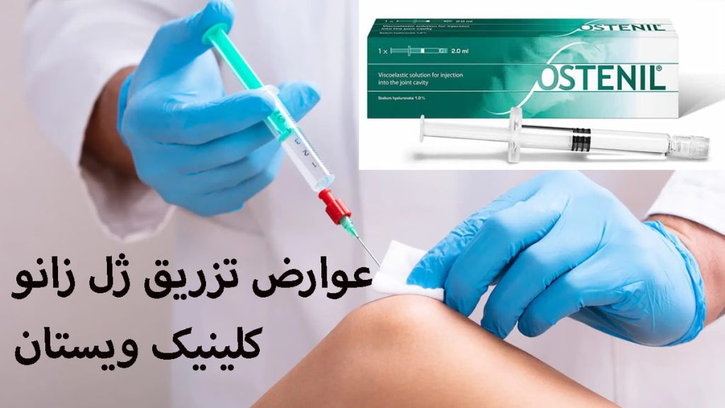 پزشک در حال تزریق به زانو و یک بسته ژل تزریقی زانو دیده می شود