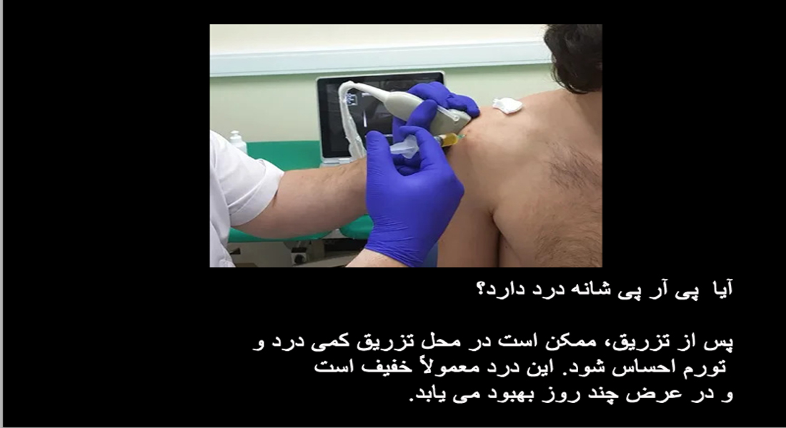 prp شانه درد پی آر پی شانه