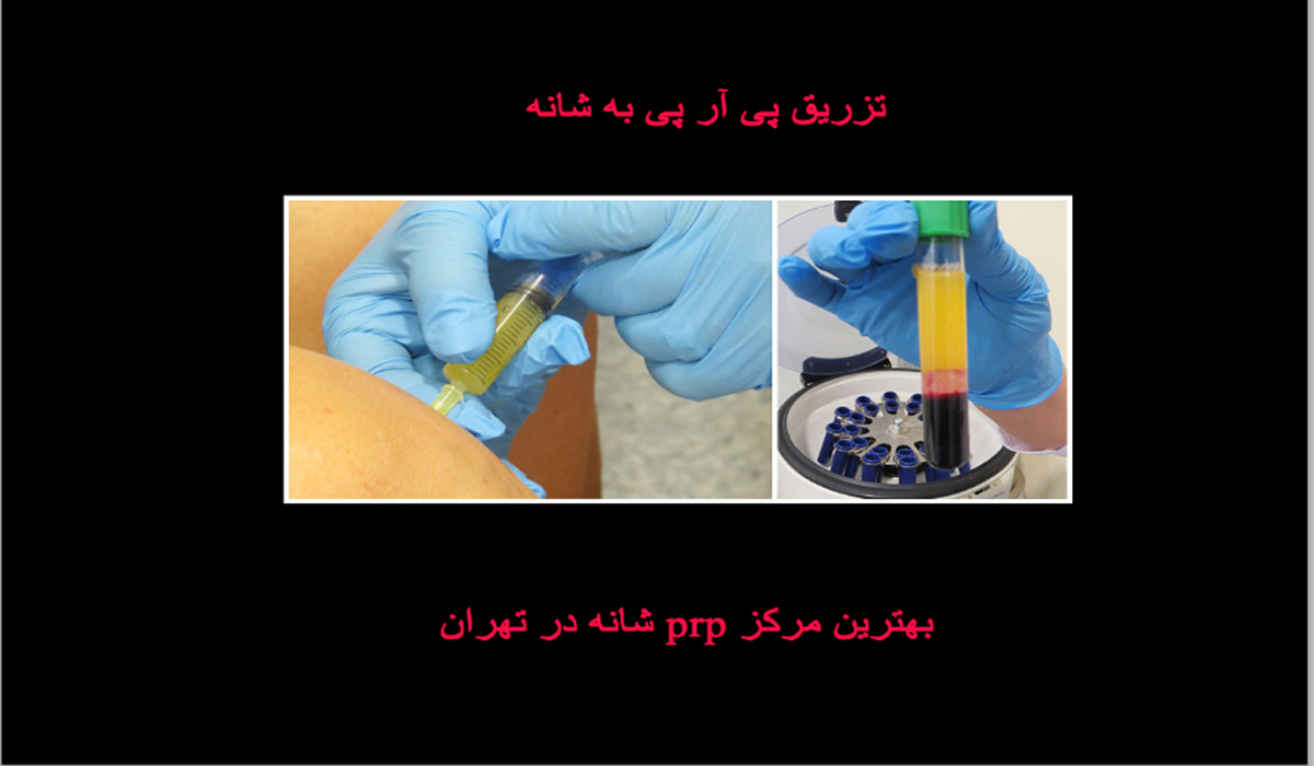 فیلم تزریق پی ار پی شانه + پی آر پی شانه درد دارد؟نظرات مردم