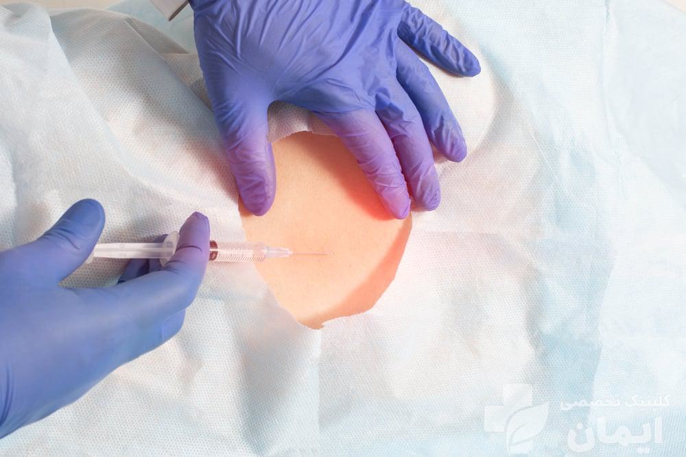 دکتر اپیدورال کمر دکتر متخصص اپیدورال کمر