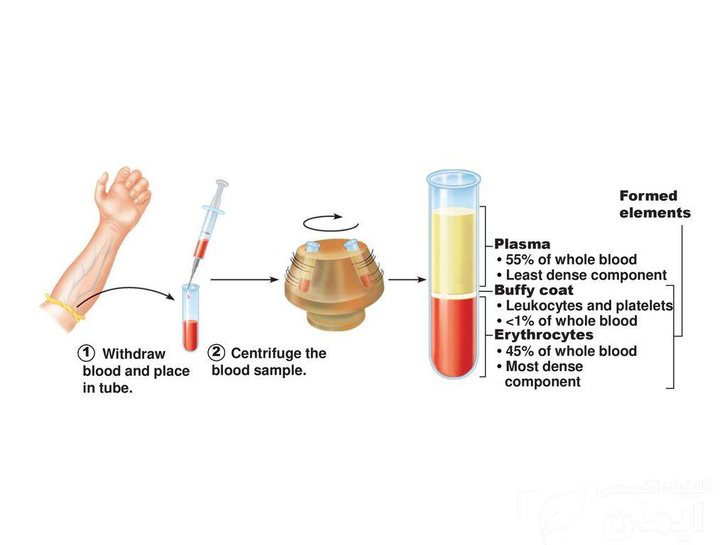 عوارض آمپول پی آر پی چیست+کیا از پی آر پی جواب گرفتن؟ نظرات