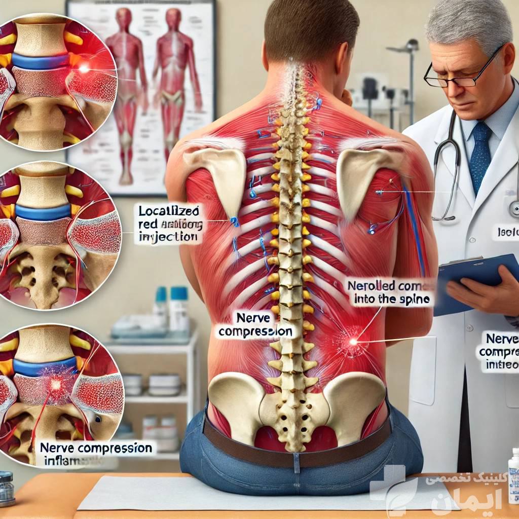 تزریق غضروف توسط پزشک پزشک در حال انجام تزریق غضروف به کمر بیمار