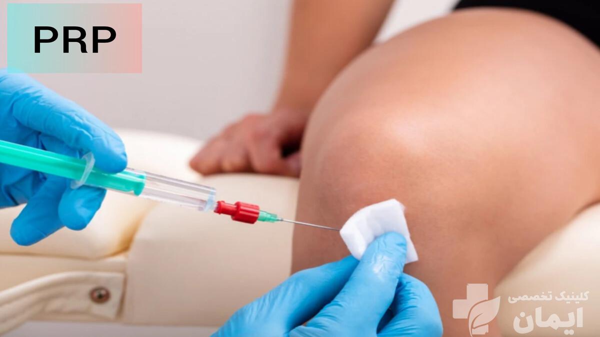 انجام تزریق پی آر پی توسط پزشک