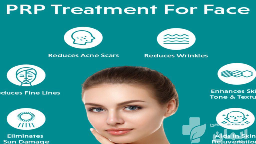 بهبود مشکلات پوستی با PRP PRP برای بهبود مشکلات پوستی در یک خانم