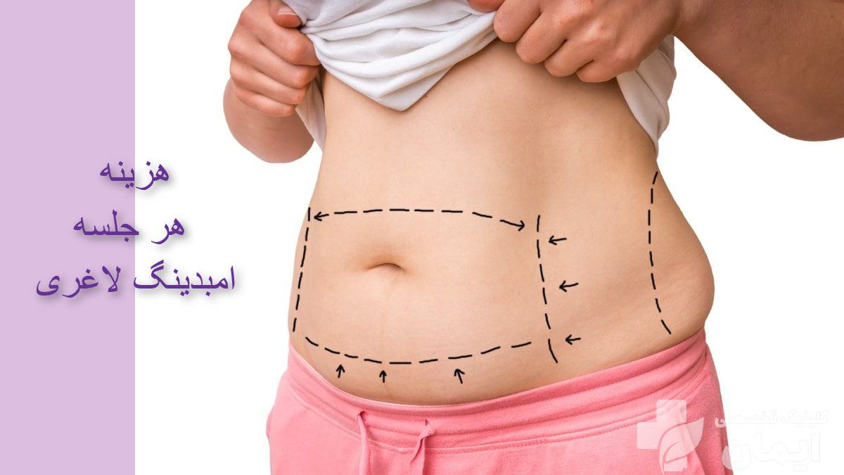 هزینه هر جلسه امبدینگ در سال 1403