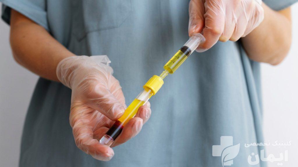 پی آر پی آماده شده برای تزریق به بیمار پزشک در حال آماده شدن برای تزریق پی آر پی