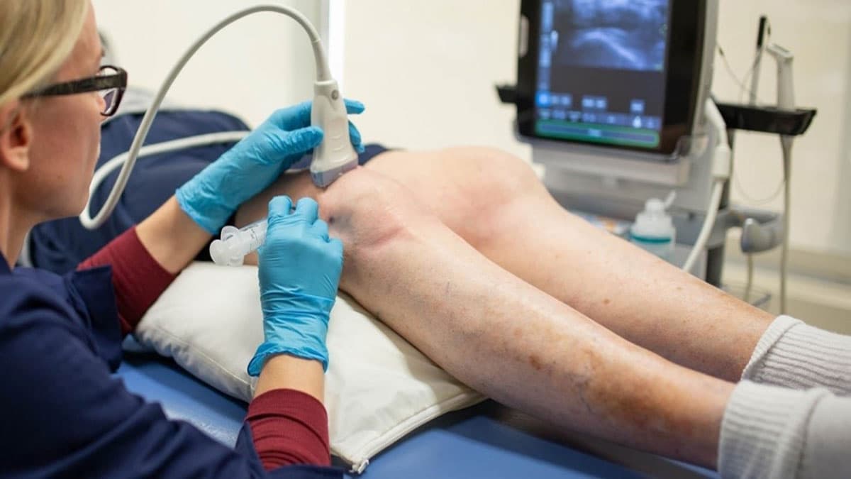 پزشک در حال پی آر پی زانو است