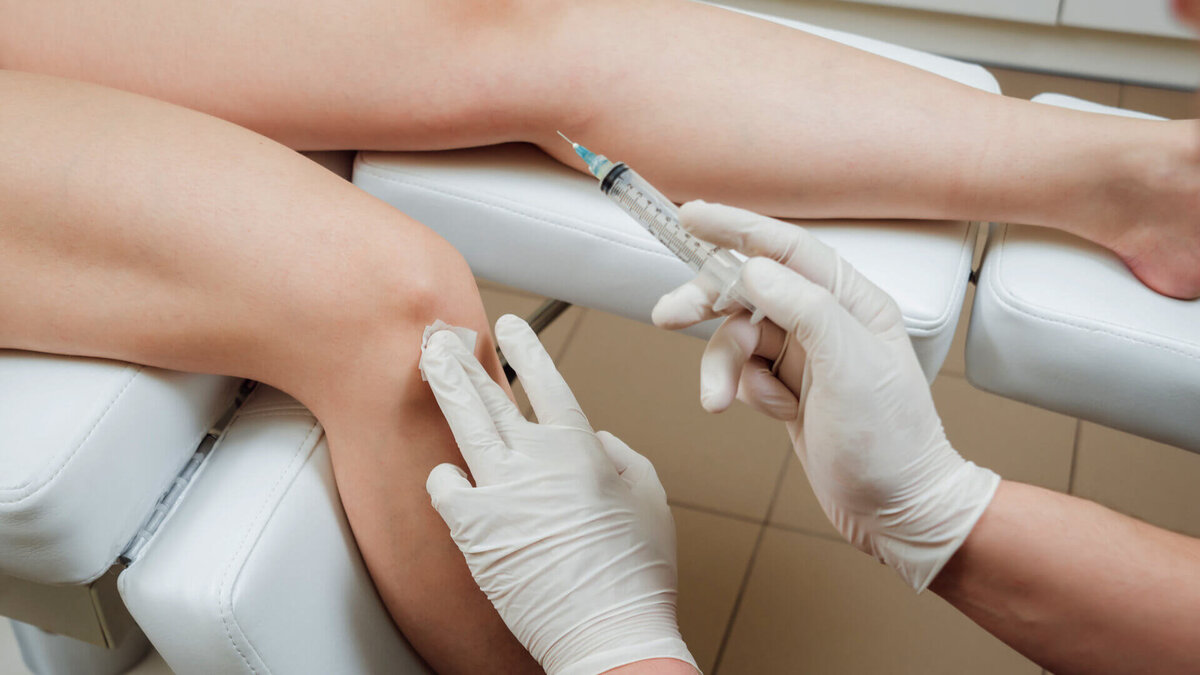 پزشک در حال انجام تزریق پلاسمای غنی از پلاکت به زانوی بیمار