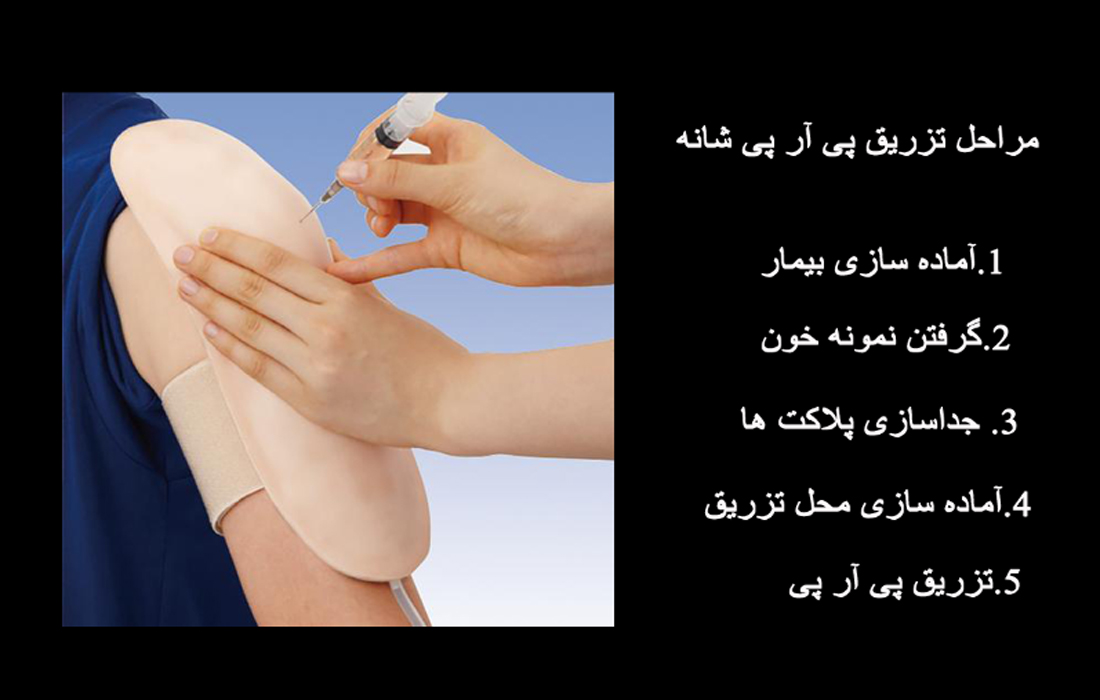 تزریق prp مراحل تزریق پی آر پی شانه