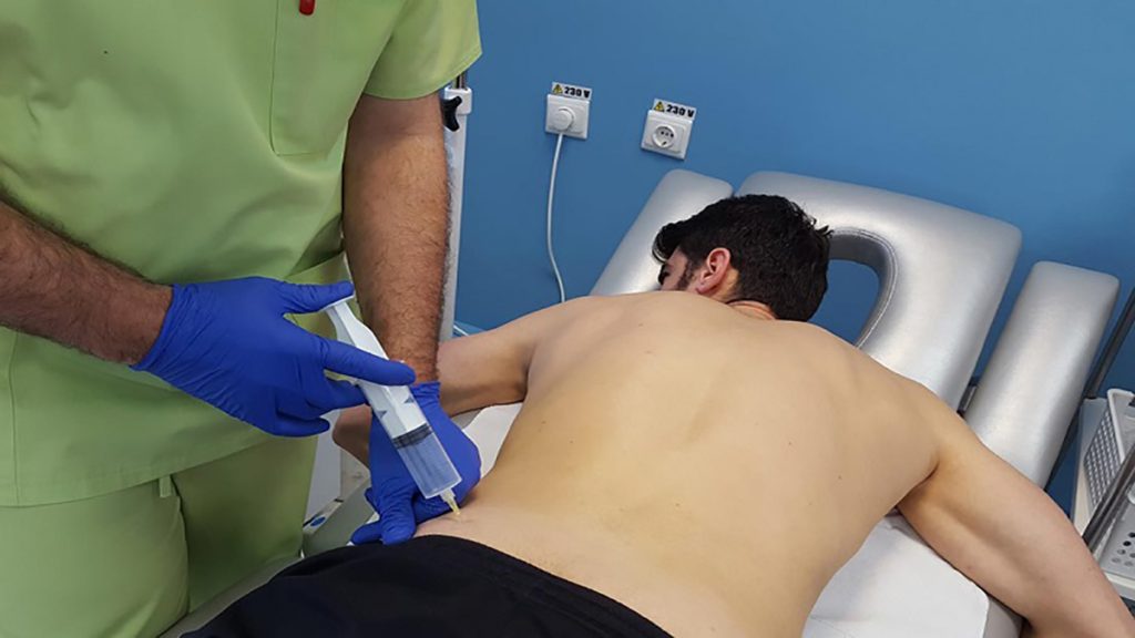 بیمار با علایم دیسک کمر که اوزون درمانی می کنند بیمار با علایم دیسک کمر که اوزون درمانی می کنند