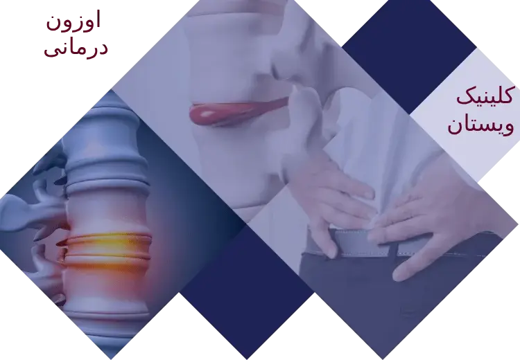 مشاوره با پزشک ضروری است. بیمار نیازی به بستری شدن ندارد.