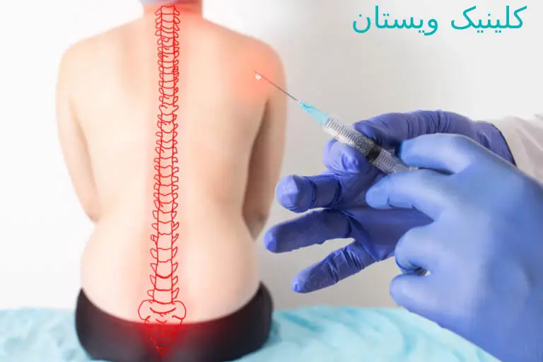 اوزون درمانی میتواند به افزایش تحرک کمک کند.