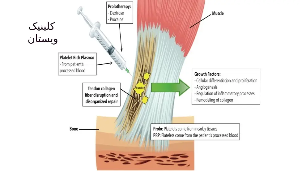 سلولهای بنیادی: نیاز به آزمایشهای دقیق و زمان بیشتر برای آمادهسازی دارند.
