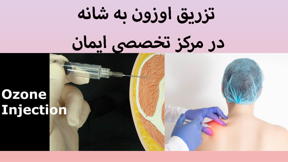 دو تصویر از تزریق اوزون به شانه