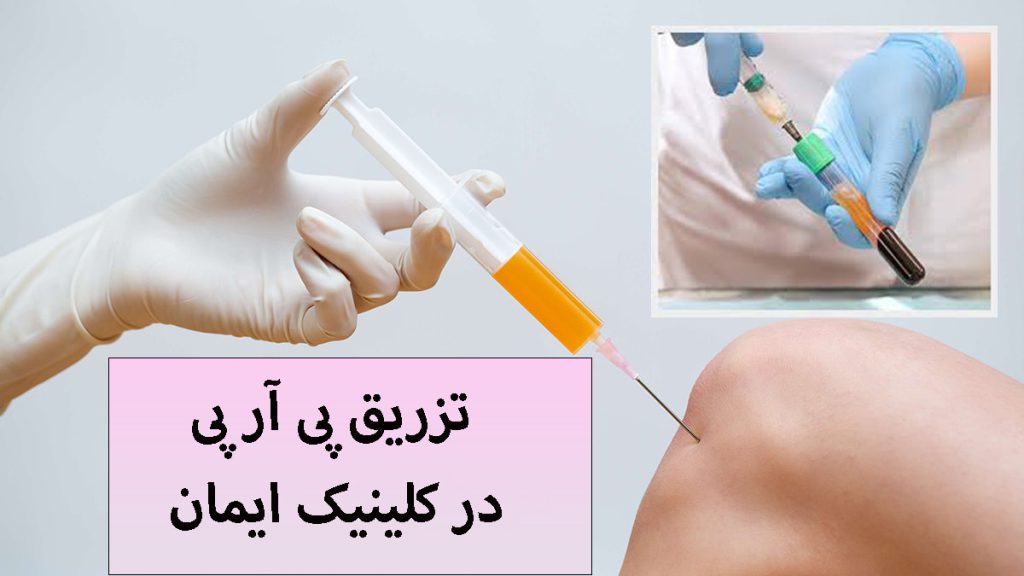 تزریق پی آر پی دو تصویر از تزریق پی آر پی