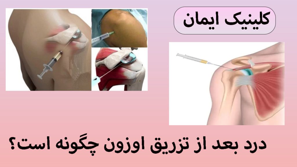 درد بعد از تزریق اوزون دو تصویر کوچک از تزریق اوزون به شانه