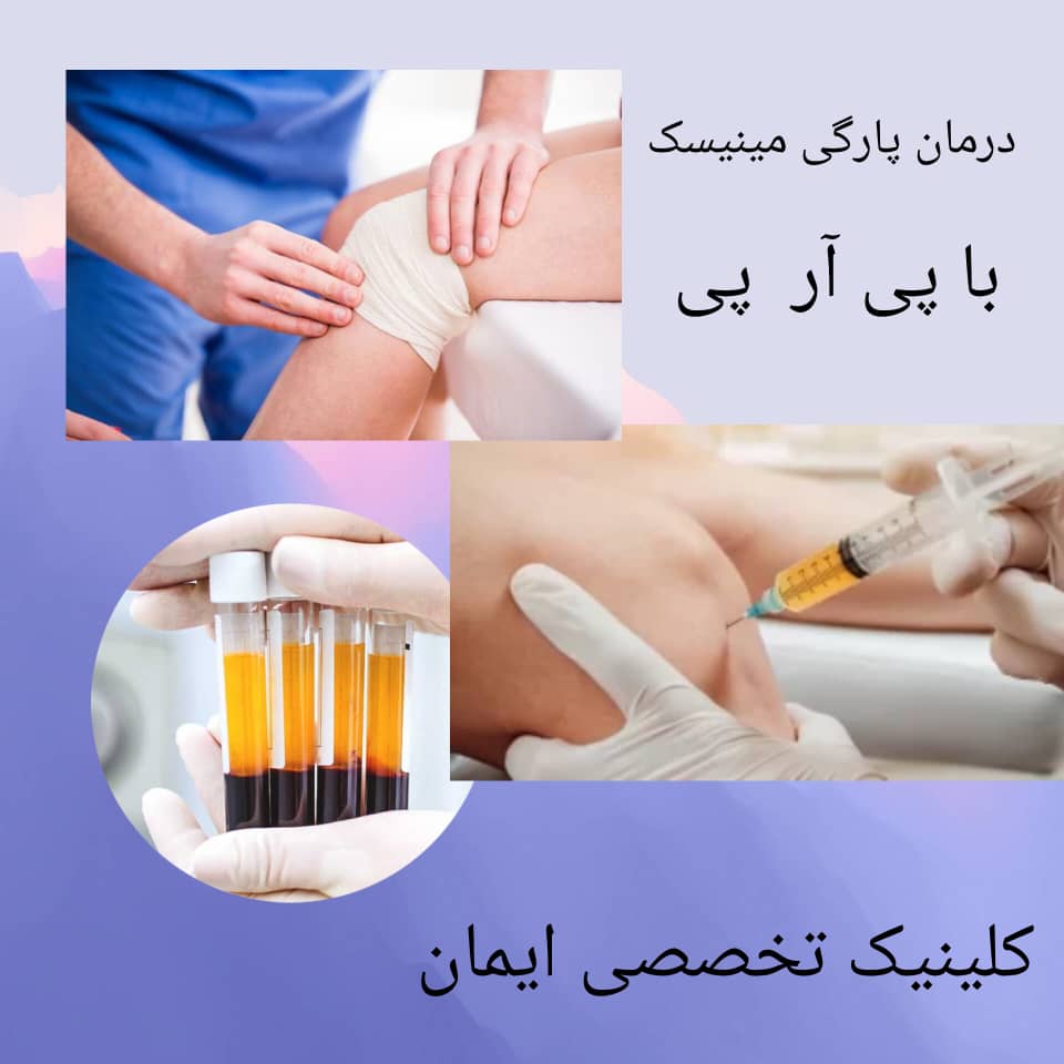 درمان پارگی مینیسک با پی آر پی