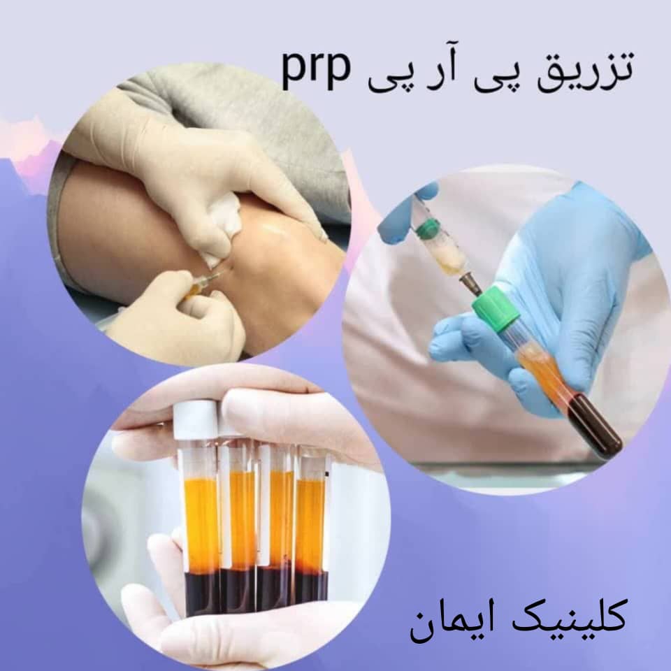 تزریق پی آر پی تزریق پی آر پی