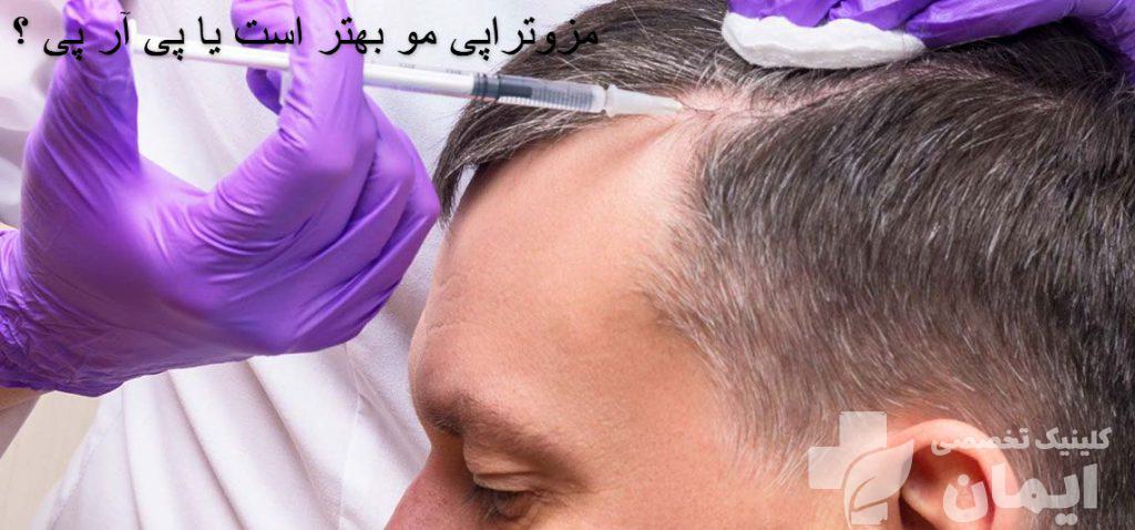 تزریق پی آر پی به سر مرد 