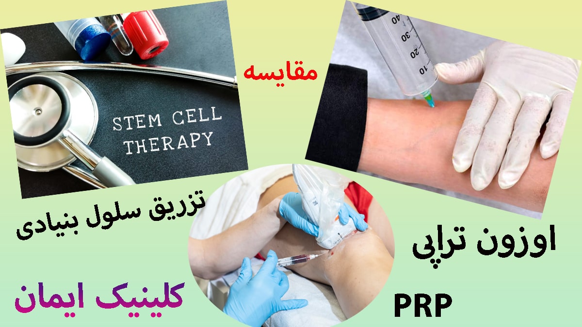 سه تصویر از مقایسه تزریق پی آر پی ، سلول های بنیادی و اوزون تراپی
