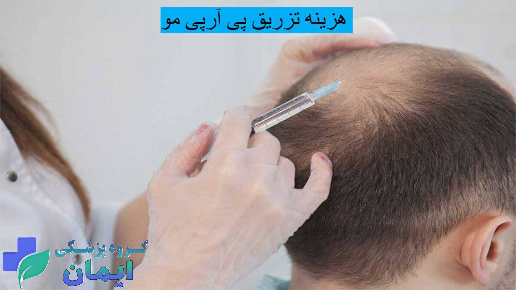 هزینه تزریق پی آر پی مو به سر یک مرد 