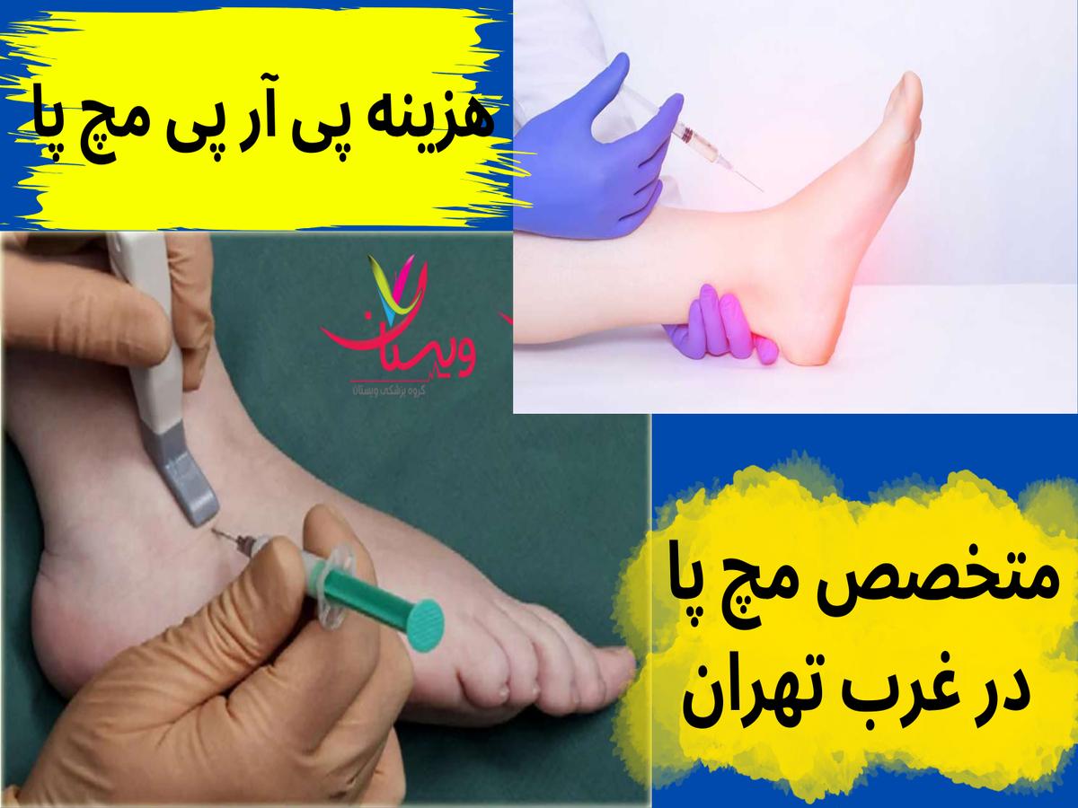 هزینه پی آر پی مچ پا در تهران