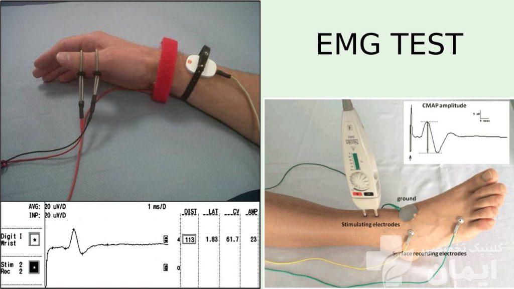 عوامل متعدد در قیمت نهایی تاثیر دارد عوامل موثر بر هزینه نوار عصب وعضله دست و پا