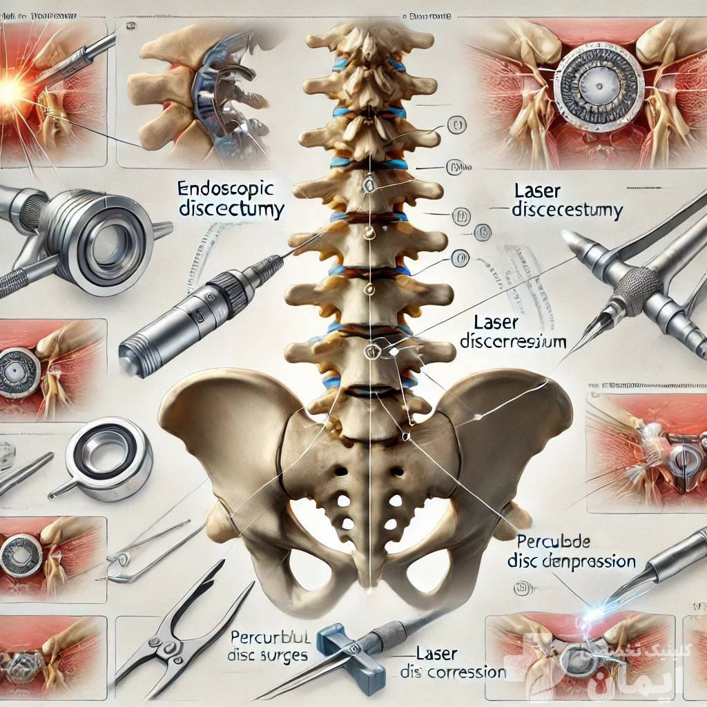 انجام عمل بسته برای دیسک کمر با روش های مختلف روش های مختلف برای عمل بسته دیسک کمر