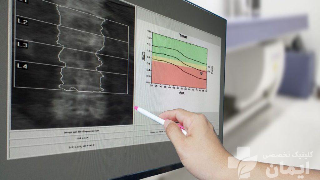 تفسیر تست استخوان توسط پزشک اسکن تراکم استخوان و بررسی هزینه آزمایش تراکم استخوان با بیمه