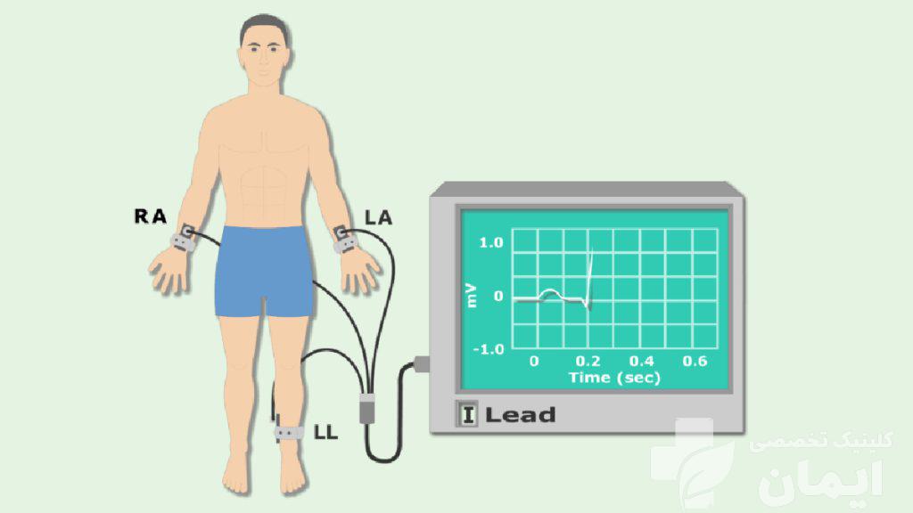 هزینه تست emg در کلینیک ایمان هزینه نوار عصب و عضله دست | با قیمت مناسب در کلینیک ایمان