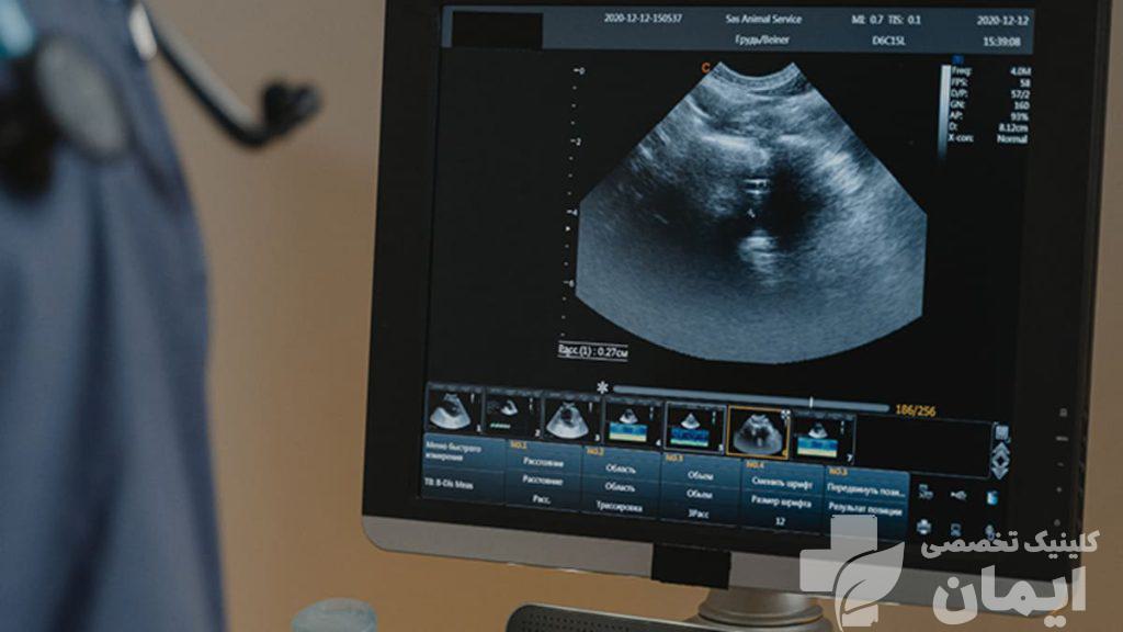 انجام سونوگرافی شکم برای تشخیص بیماری تصویری از سونوی شکم بیمار