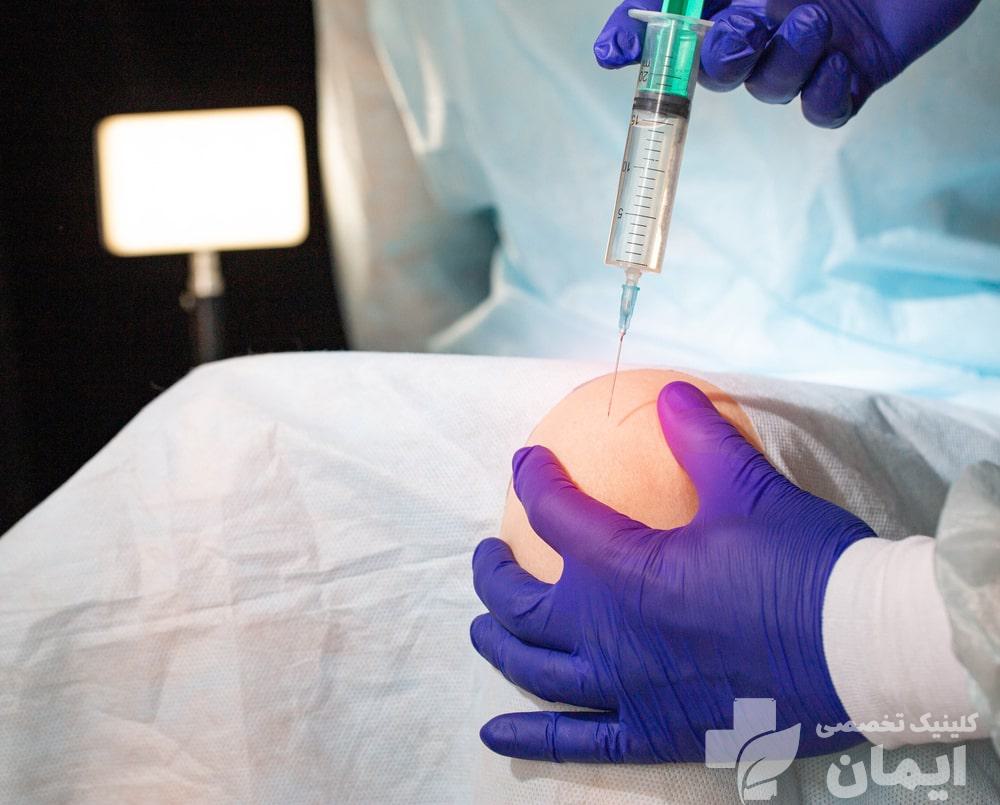 تزریق اگزوزوم تراپی درمان درد زانو تزریق اگزوزوم تراپی درمان درد زانو