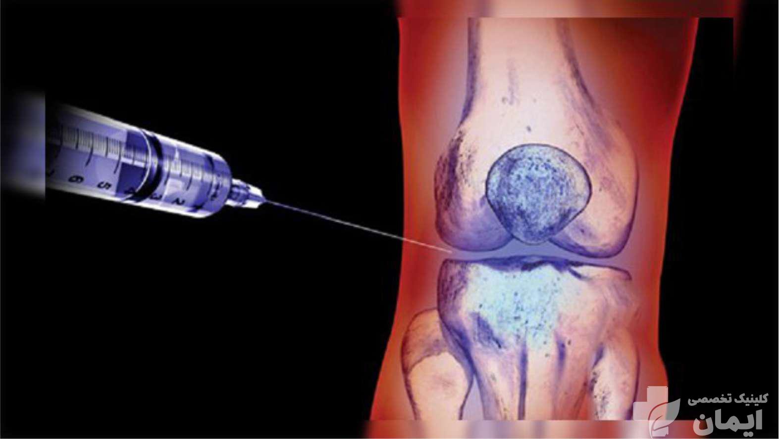 تزریق اگزوزوم تراپی روی زانو