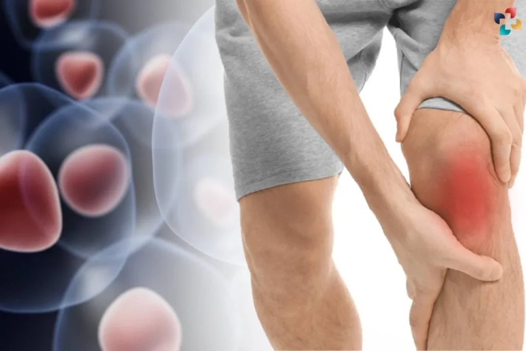 عوارض تزریق سلولهای بنیادی برای زانو