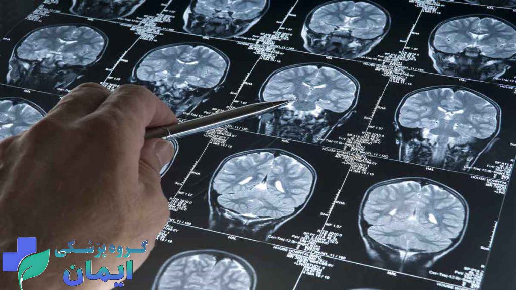 آلزایمر چگونه تشخیص داده می شود؟